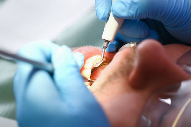 Best Pediatric Emergency Dentist in Royal Palm Estates, FL