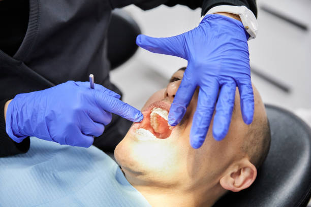 Best Emergency Root Canal Treatment in Royal Palm Estates, FL